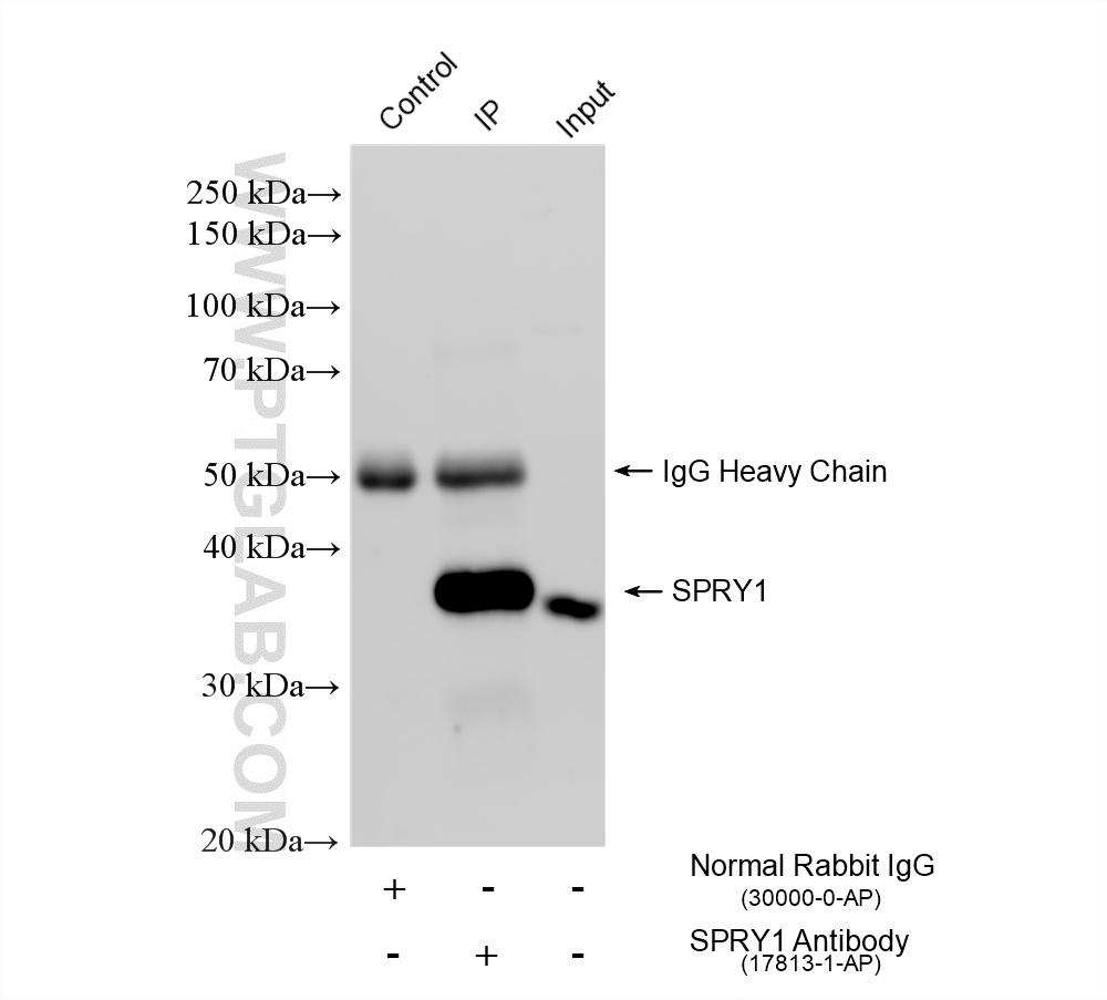 IP experiment of HT-29 using 17813-1-AP