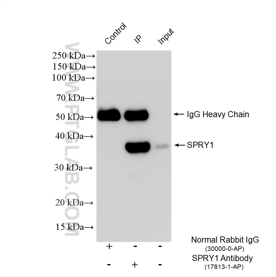 IP experiment of HT-29 using 17813-1-AP