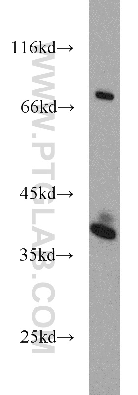 WB analysis of A375 using 11383-1-AP