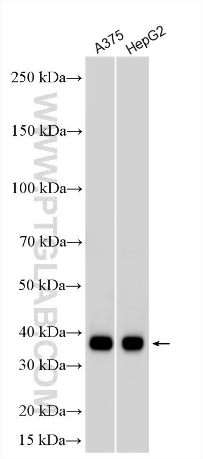 WB analysis using 22765-1-AP WB analysis using 22765-1-AP
