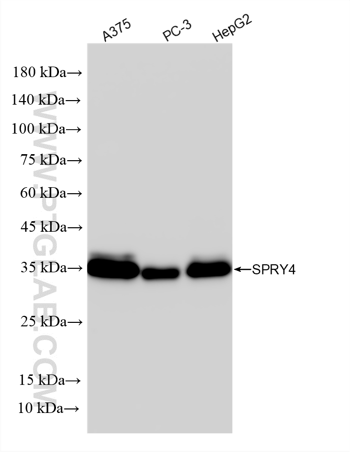 WB analysis using 87666-1-RR (same clone as 87666-1-PBS) WB analysis using 87666-1-RR (same clone as 87666-1-PBS)
