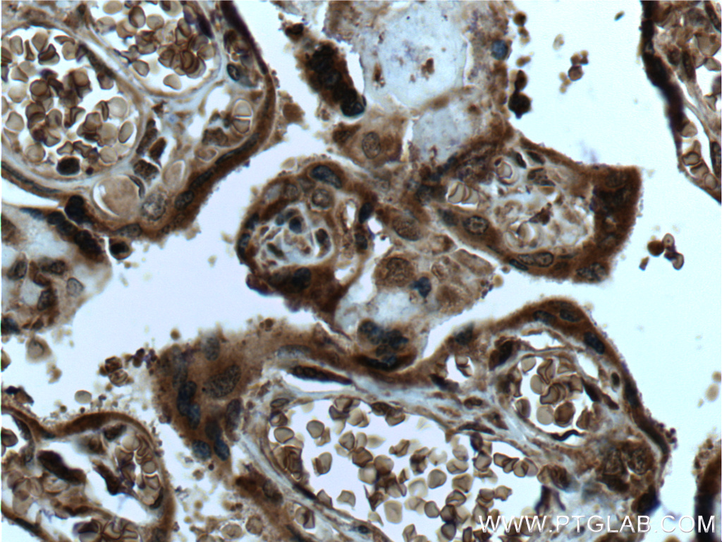 IHC staining of human placenta using 20802-1-AP