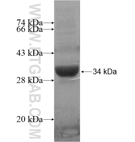 SPRYD5 fusion protein Ag14723 SDS-PAGE