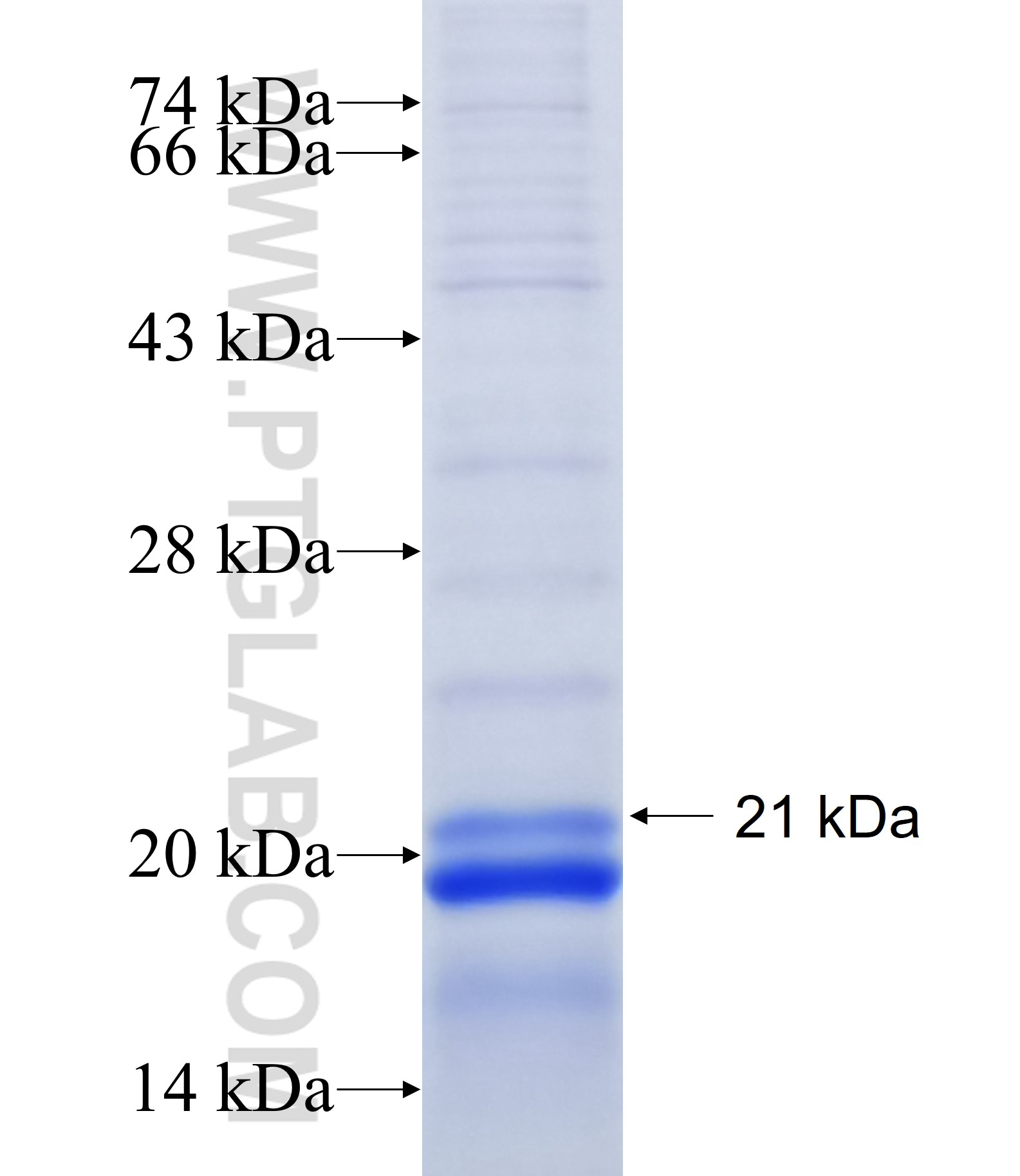 SPSB2 fusion protein Ag16816 SDS-PAGE SPSB2 fusion protein Ag16816 SDS-PAGE