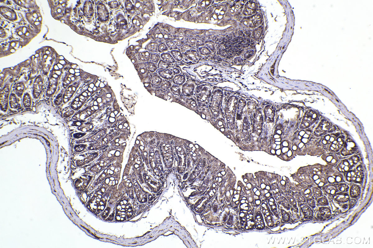 IHC staining of mouse colon using 31676-1-AP