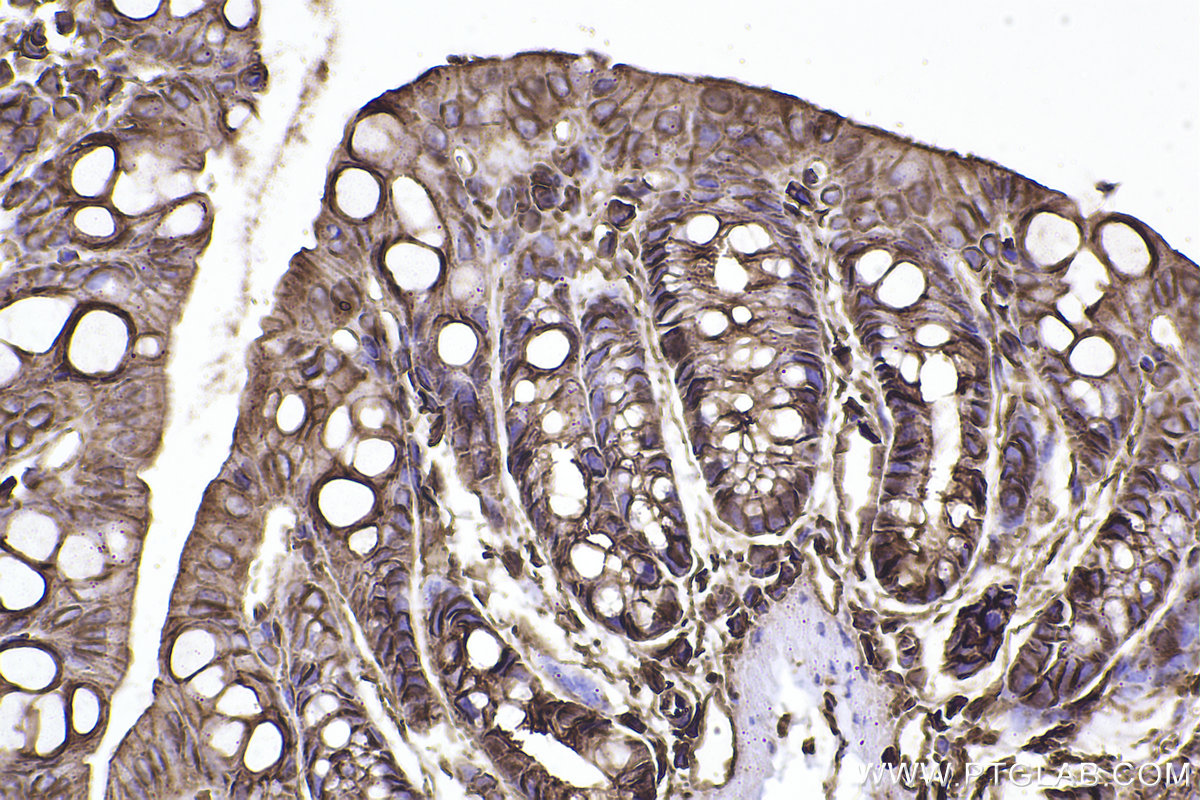 IHC staining of mouse colon using 31676-1-AP