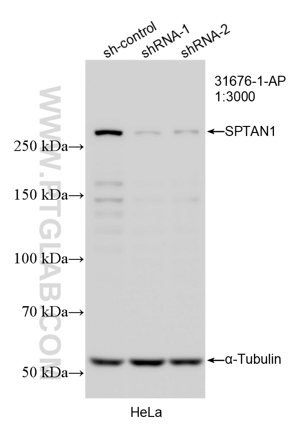 WB result of SPTAN1 antibody (31676-1-AP; 1:3000; incubated at room temperature for 1.5 hours) with sh-Control and sh-SPTAN1 transfected HeLa cells. WB analysis of HeLa using 31676-1-AP