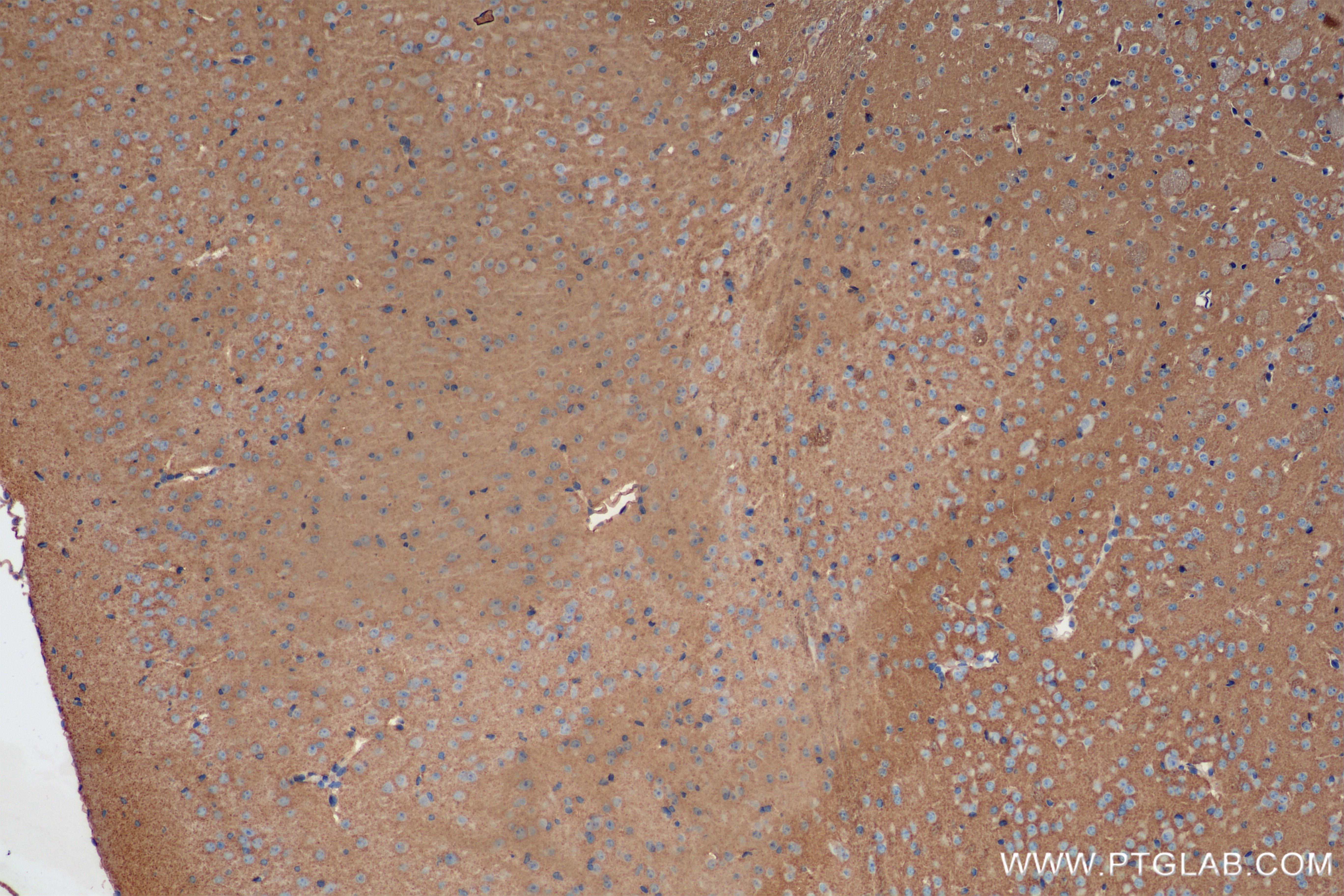 IHC staining of mouse brain using 84761-2-RR