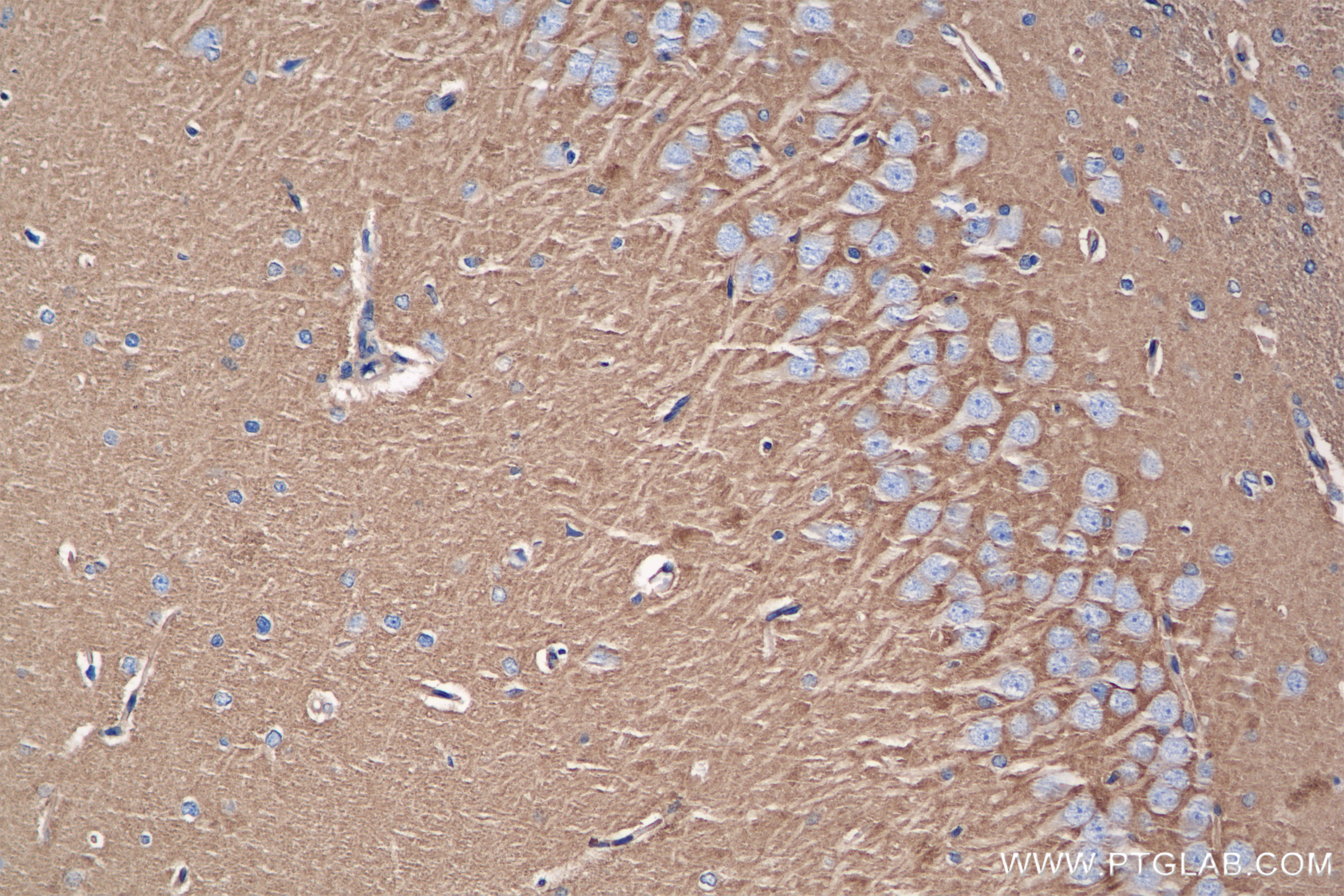 IHC staining of rat brain using 84761-2-RR