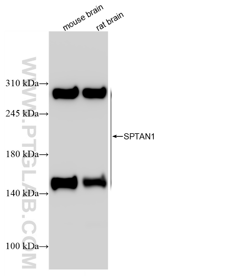 WB analysis of mouse brain using 84761-2-RR