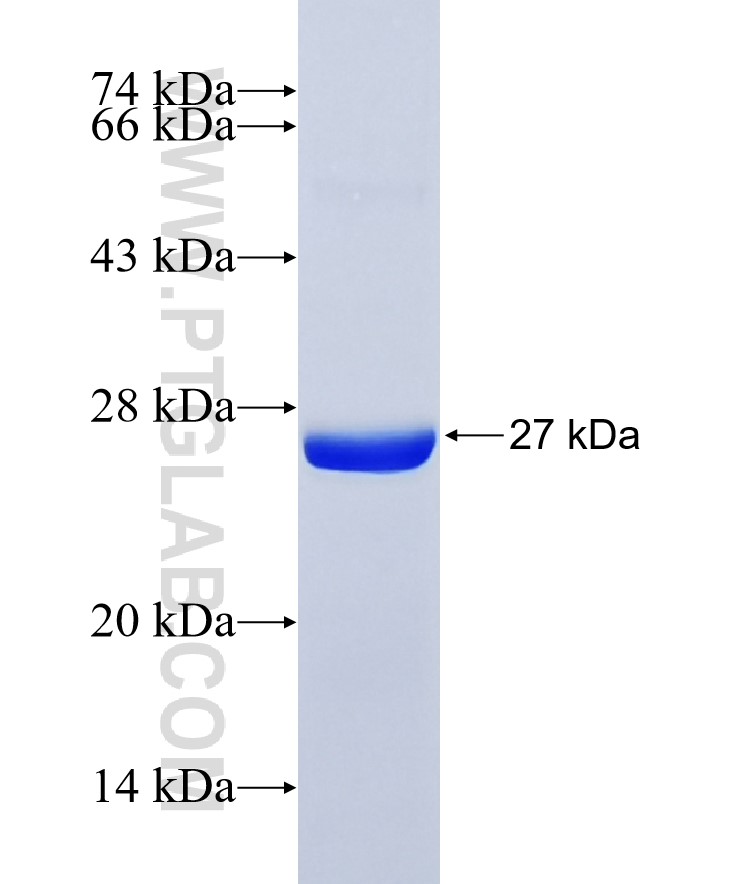 SPTAN1 fusion protein Ag36499 SDS-PAGE SPTAN1 fusion protein Ag36499 SDS-PAGE
