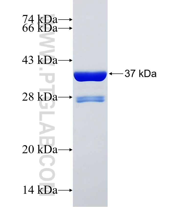 SPTB fusion protein Ag25614 SDS-PAGE