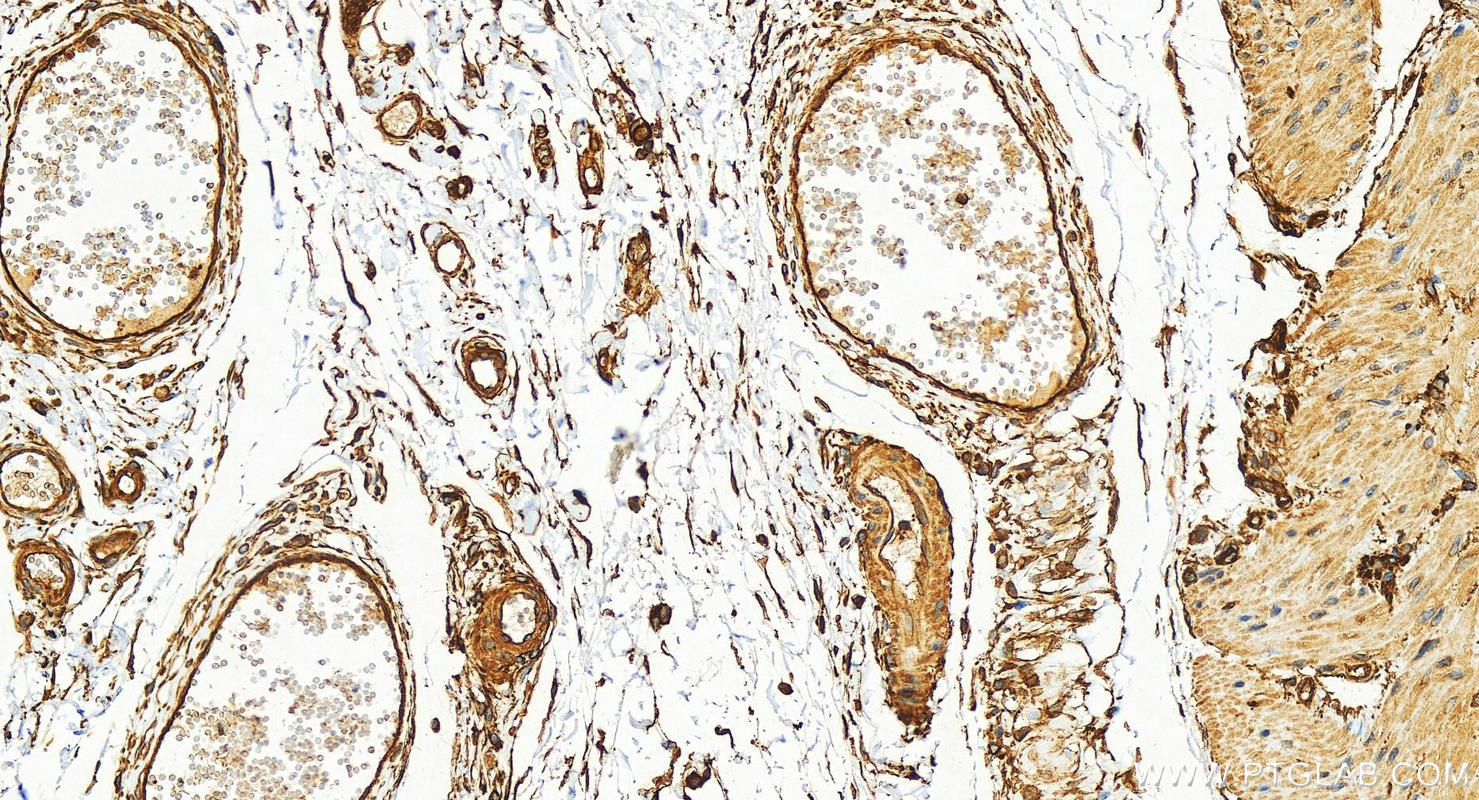 Immunohistochemical analysis of paraffin-embedded human stomach tissue slide using 25681-1-AP (SPTBN1 antibody) at dilution of 1:300 (under 20x lens). Heat mediated antigen retrieval with Tris-EDTA buffer (pH 9.0). IHC staining of human stomach using 25681-1-AP