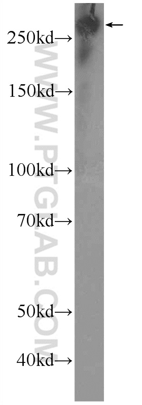 WB analysis of HEK-293 using 25681-1-AP