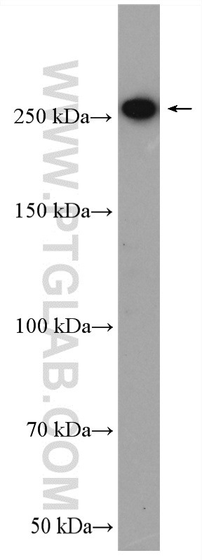 WB analysis of mouse brain using 19722-1-AP