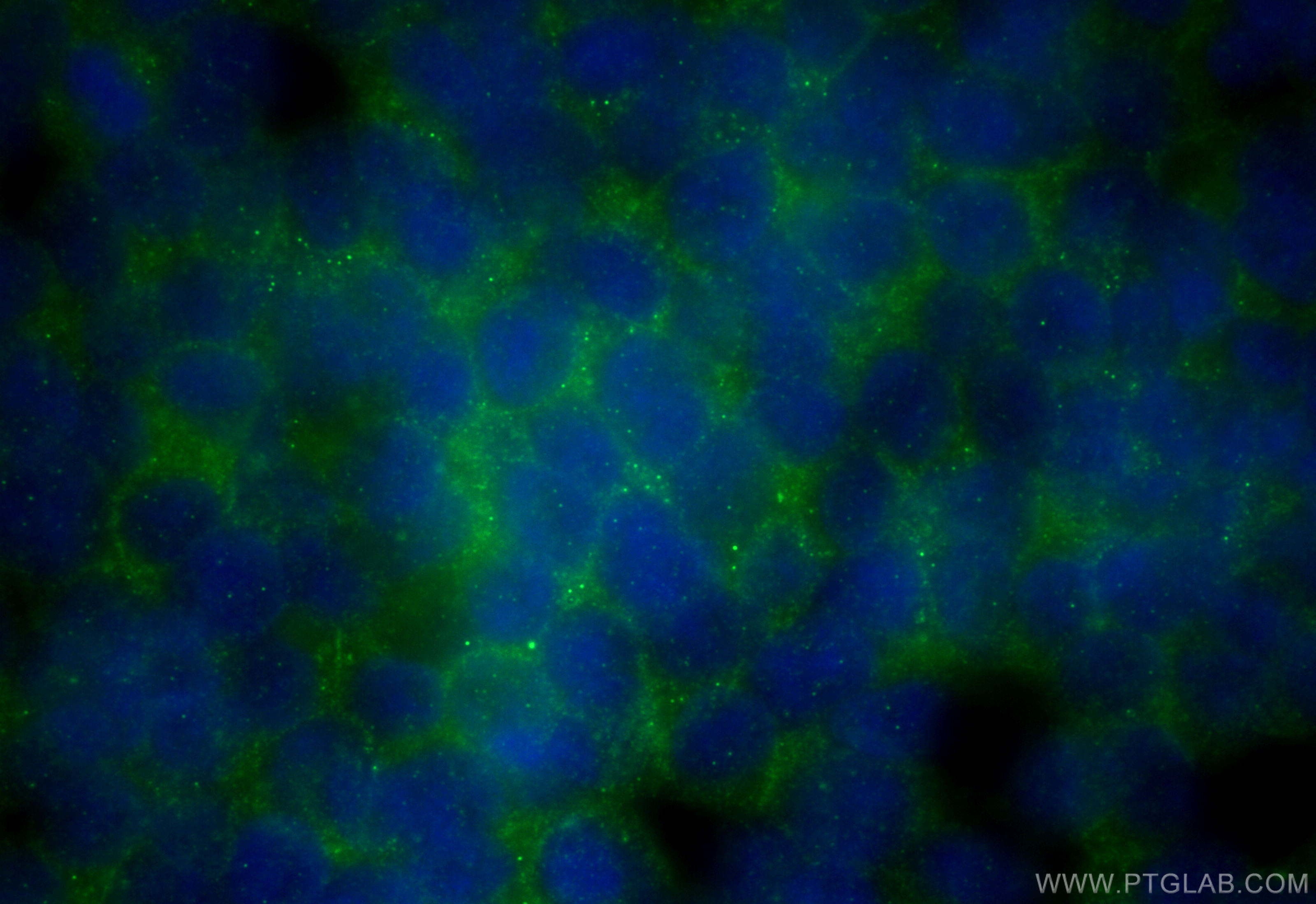 IF Staining of SH-SY5Y using 31713-1-AP