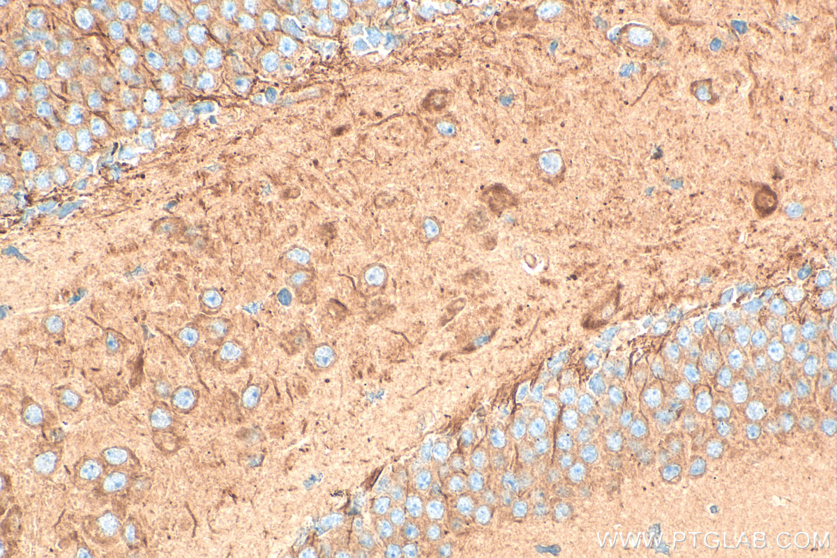 IHC staining of mouse brain using 31713-1-AP
