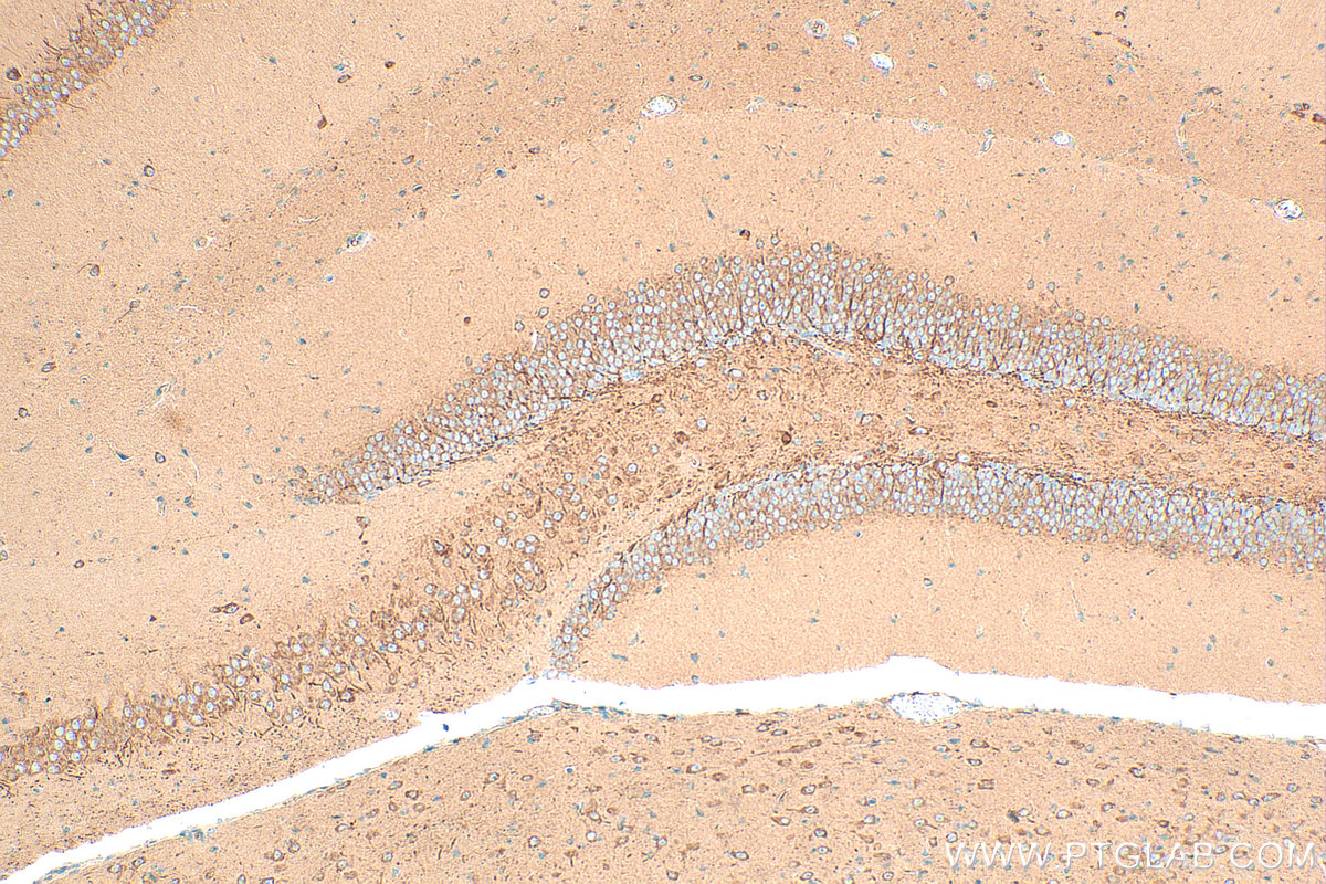 IHC staining of mouse brain using 31713-1-AP