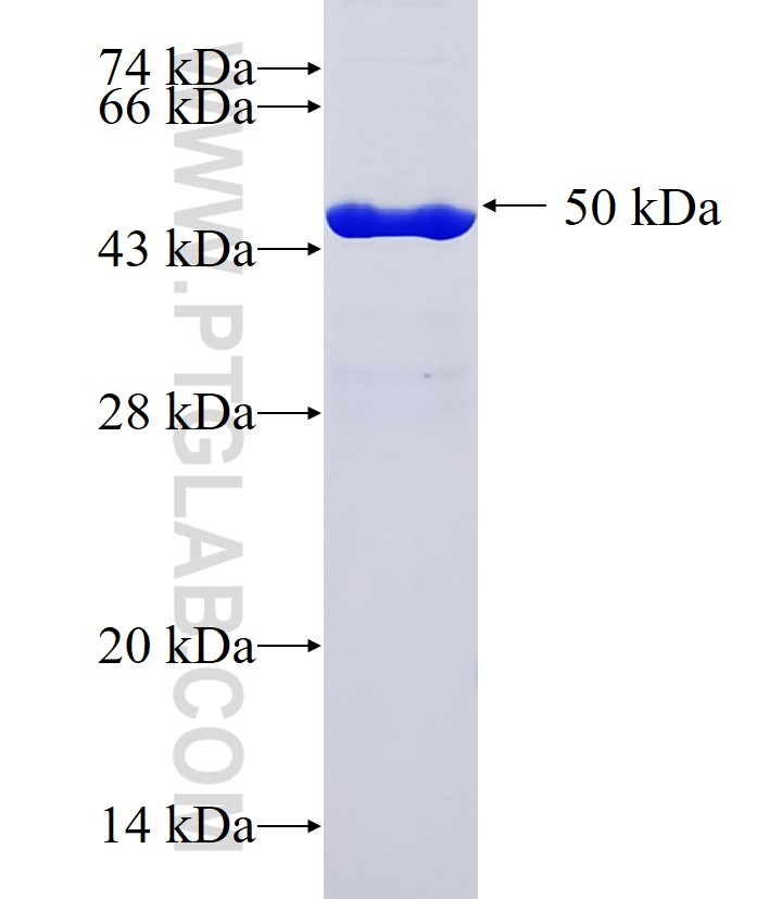 SPTBN5 fusion protein Ag37295 SDS-PAGE SPTBN5 fusion protein Ag37295 SDS-PAGE