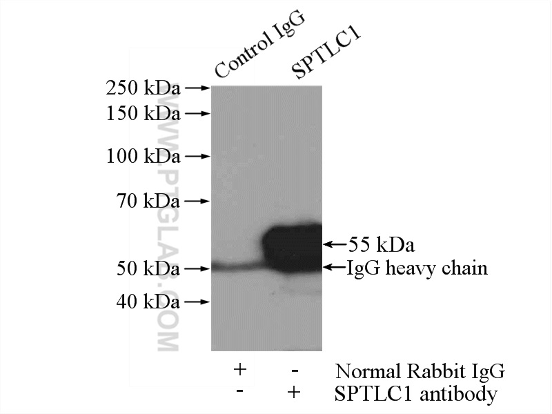 IP experiment of HEK-293 using 15376-1-AP