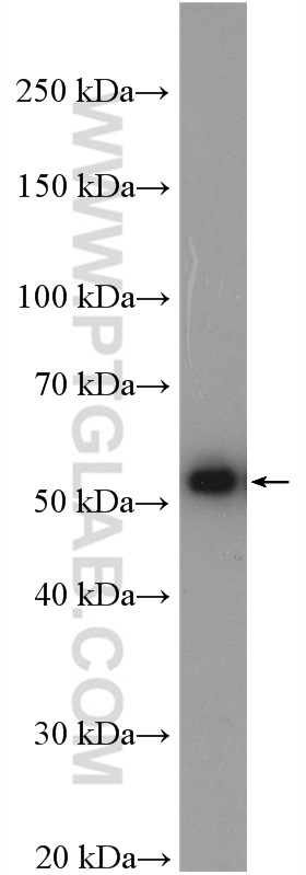 WB analysis of Jurkat using 15376-1-AP