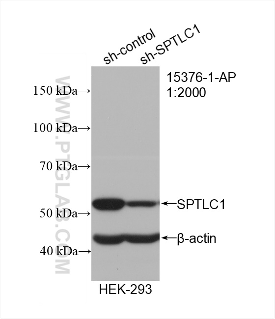 WB analysis of HEK-293 using 15376-1-AP