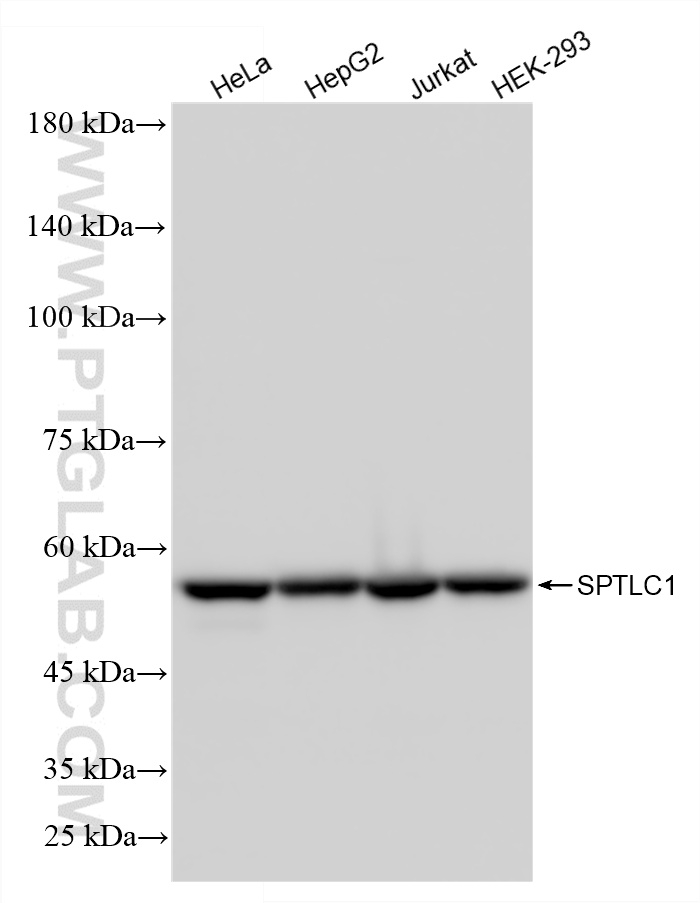 WB analysis using 87141-1-RR (same clone as 87141-1-PBS)