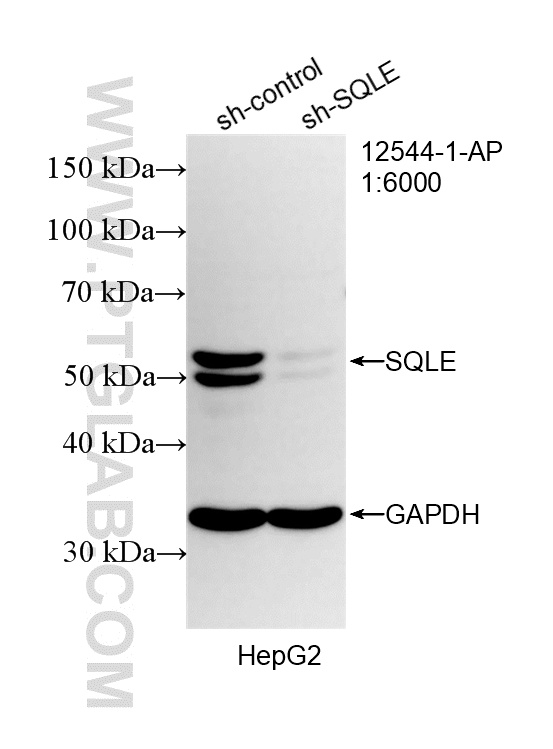 WB analysis of HepG2 using 12544-1-AP