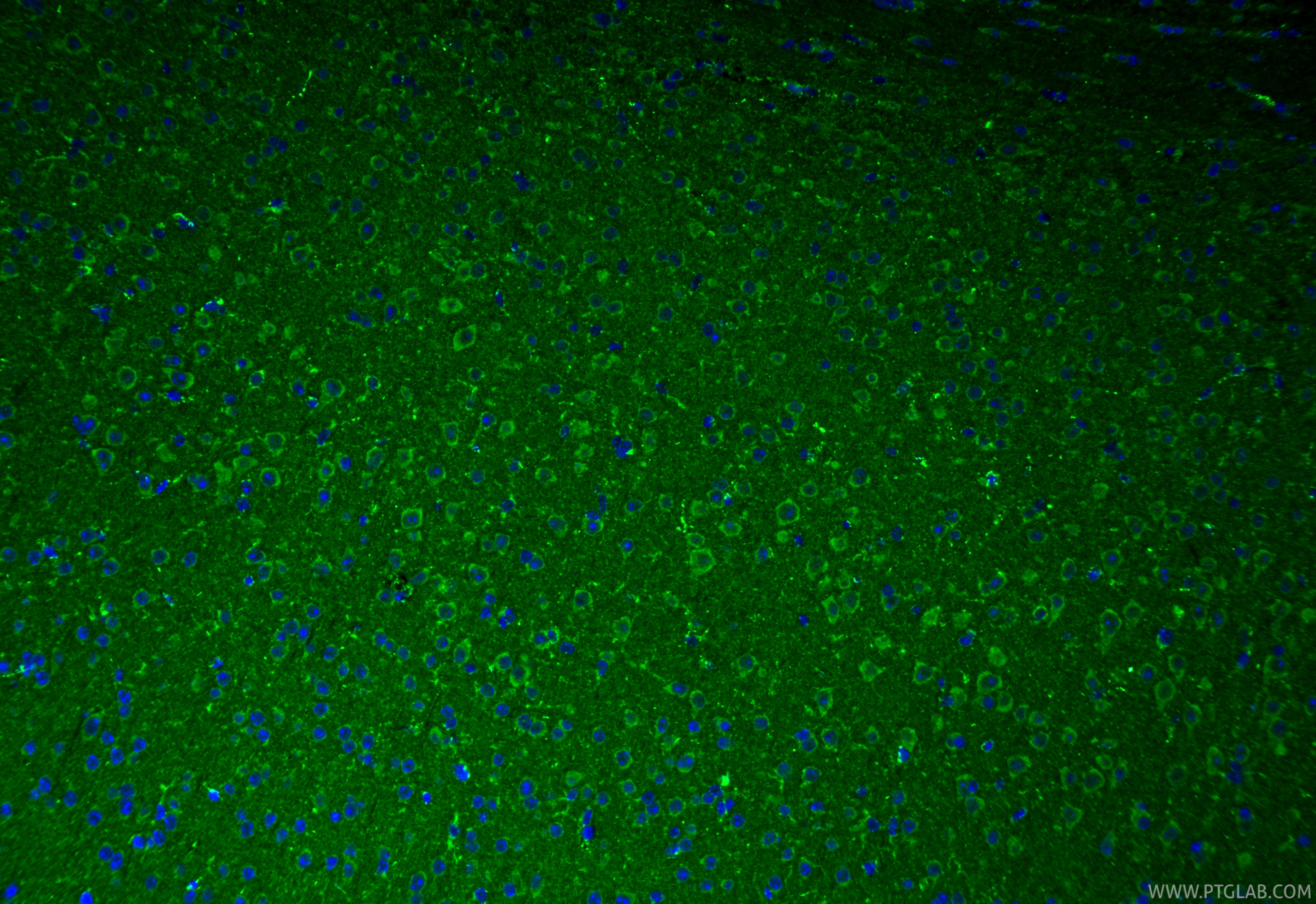 IF Staining of mouse brain using 17256-1-AP IF Staining of mouse brain using 17256-1-AP