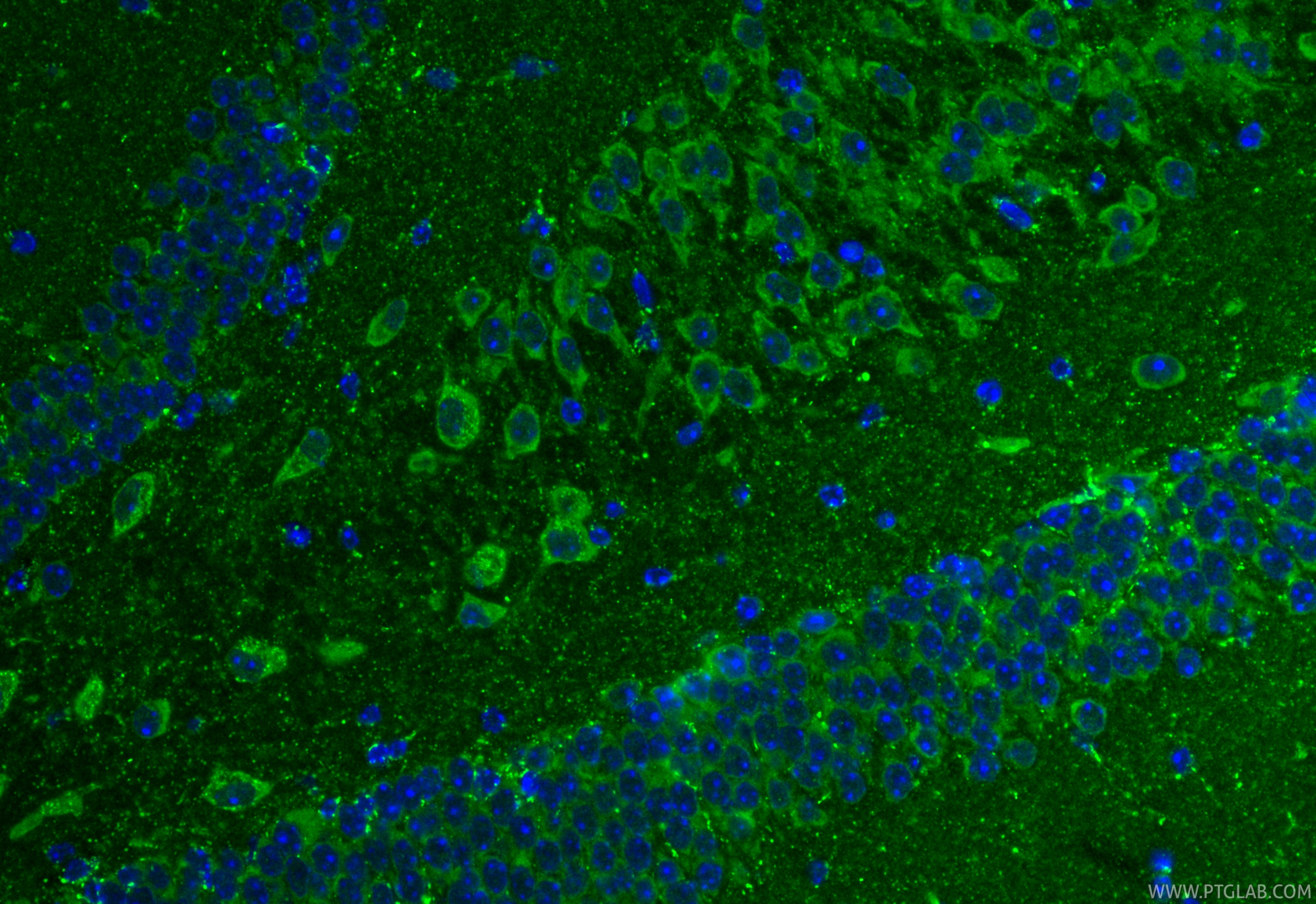 IF Staining of mouse brain using 17256-1-AP IF Staining of mouse brain using 17256-1-AP