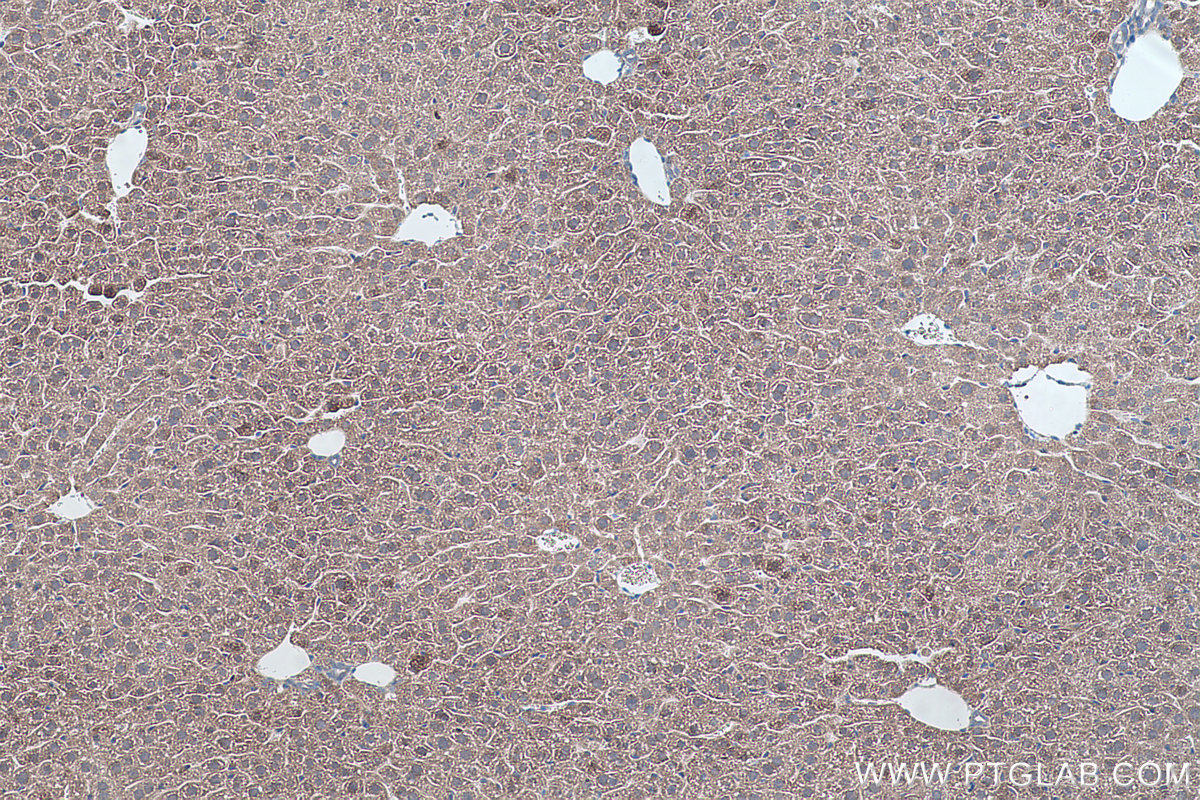 IHC staining of mouse liver using 17256-1-AP