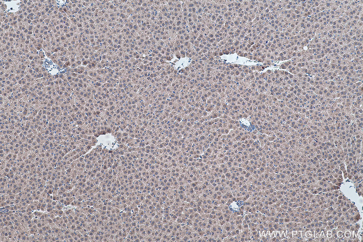 IHC staining of rat liver using 17256-1-AP