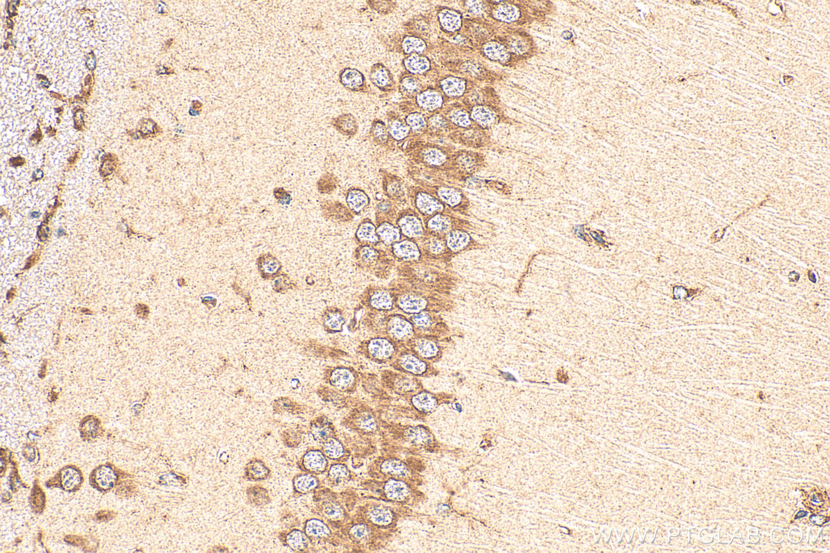 Immunohistochemical analysis of paraffin-embedded mouse brain tissue slide using <a class='green' href='/productredirect?CatalogNo=17256-1-AP' target='_blank'>17256-1-AP</a> (SQRDL antibody) at dilution of 1:200 (under 40x lens). Heat mediated antigen retrieval with Tris-EDTA buffer (pH 9.0). This data was developed using the same antibody clone with 17256-1-PBS in a different storage buffer formulation. IHC staining of mouse brain using 17256-1-AP (same clone as 17256-1-PBS)