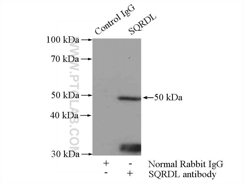 IP experiment of HeLa using 17256-1-AP (same clone as 17256-1-PBS)