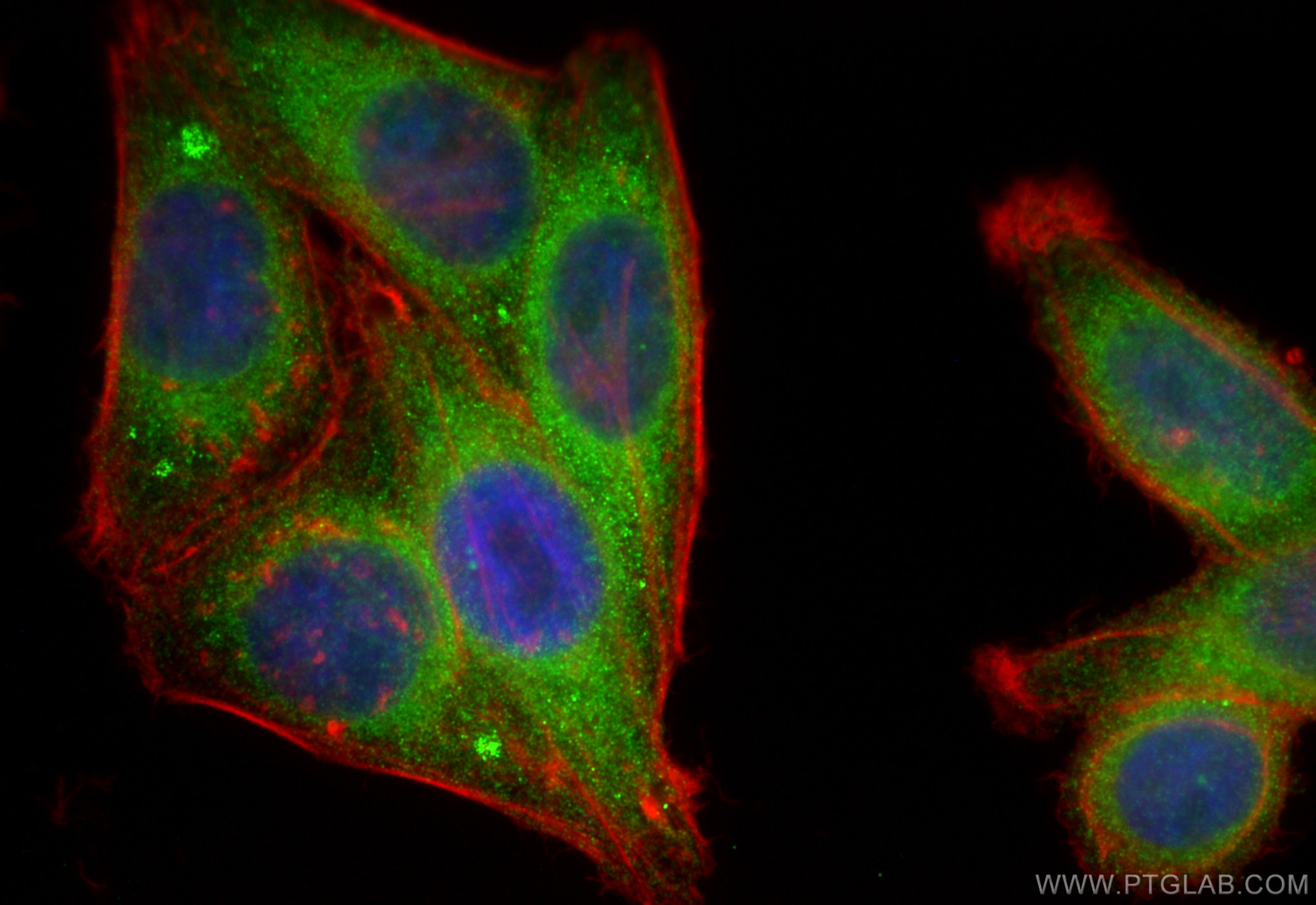 IF Staining of HepG2 using 13128-1-AP