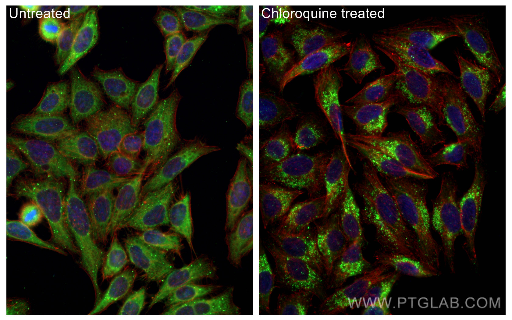 IF Staining of HepG2 using 18420-1-AP