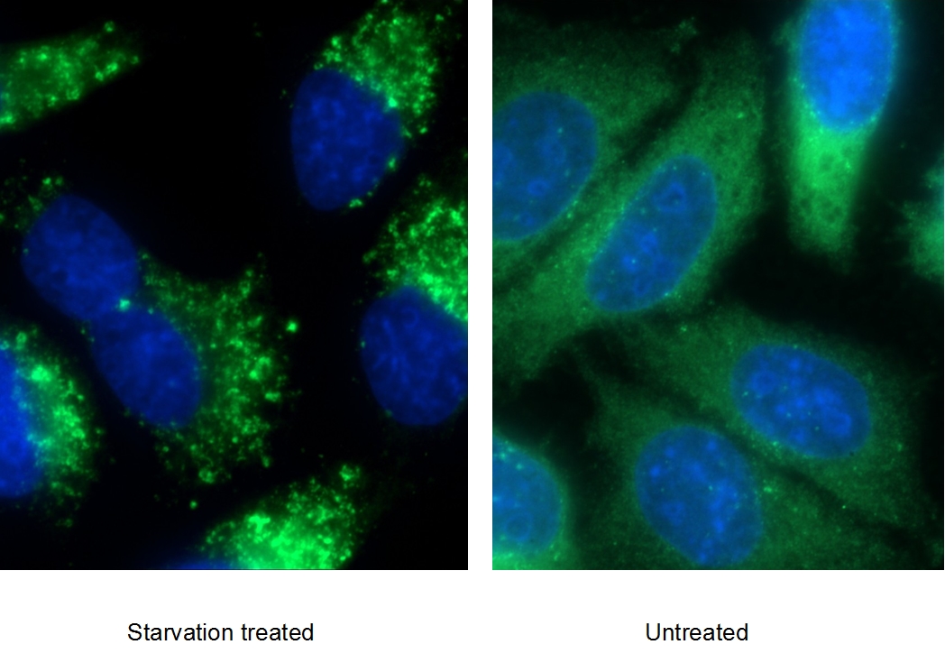 IF Staining of HepG2 using 18420-1-AP