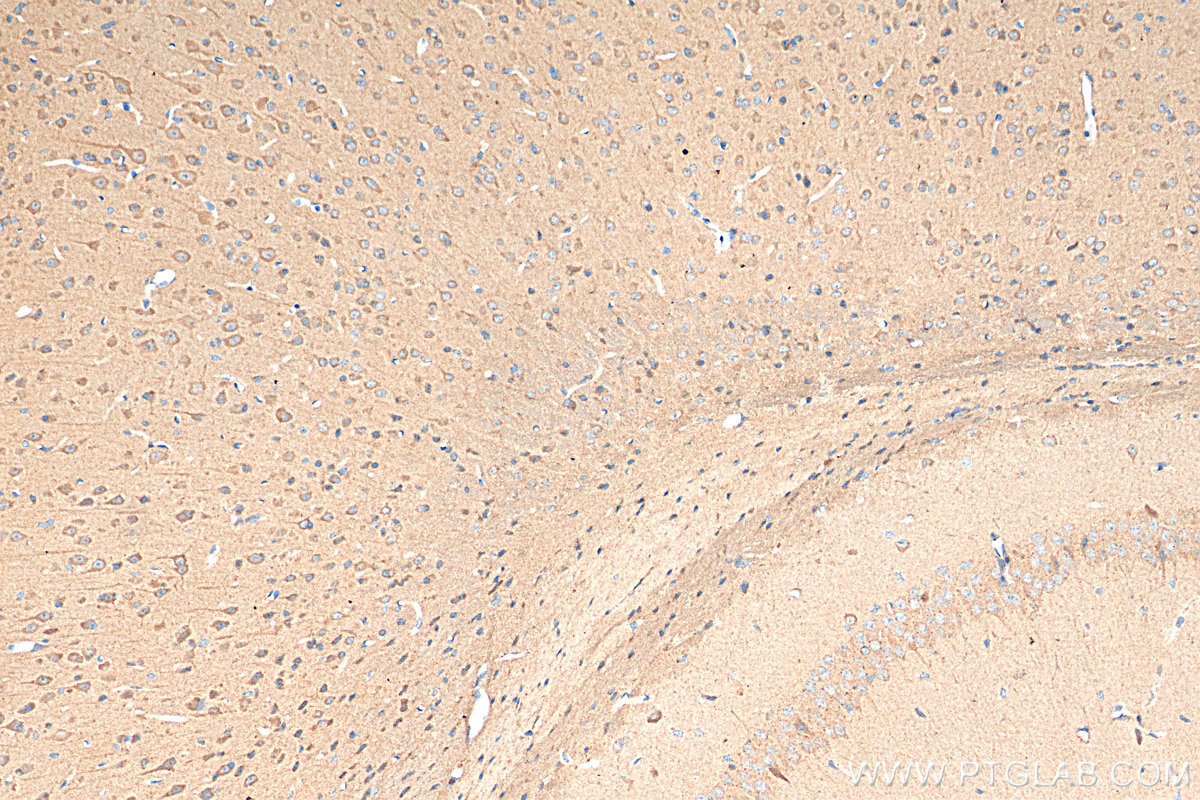 IHC staining of mouse brain using 18420-1-AP