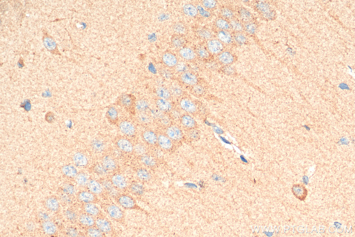 IHC staining of mouse brain using 18420-1-AP