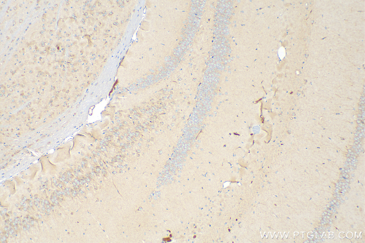 IHC staining of mouse brain using 18420-1-AP