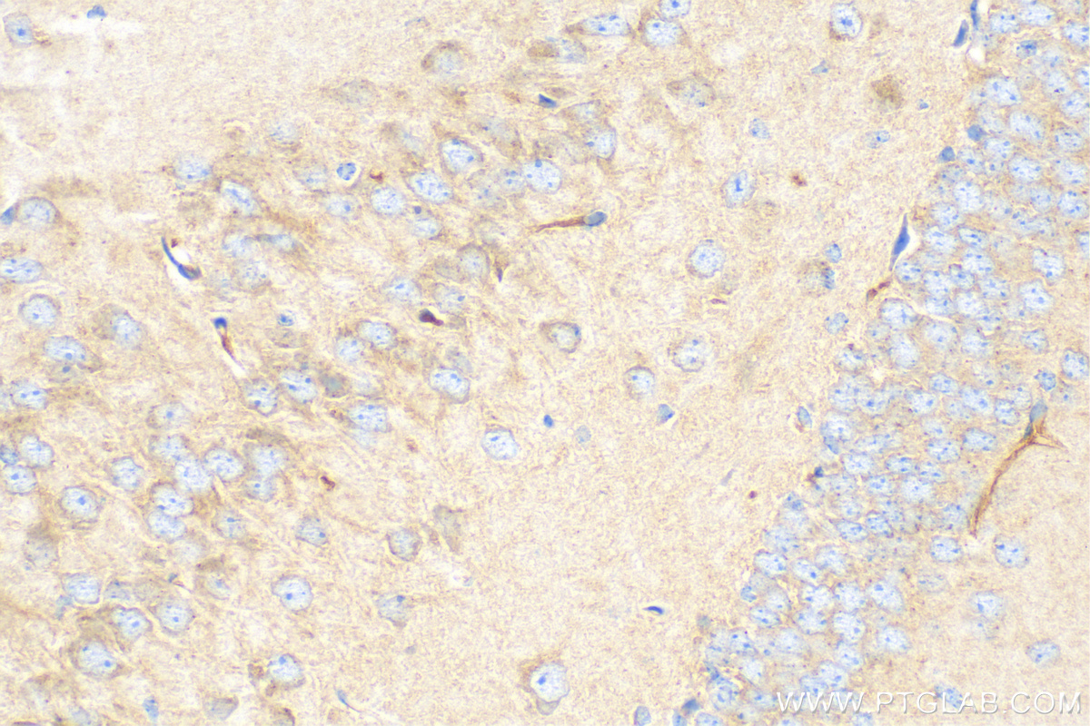 IHC staining of mouse brain using 18420-1-AP