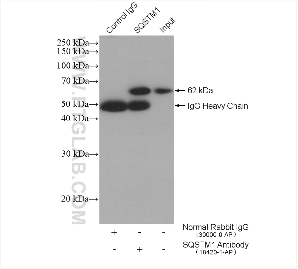 IP experiment of HEK-293 using 18420-1-AP