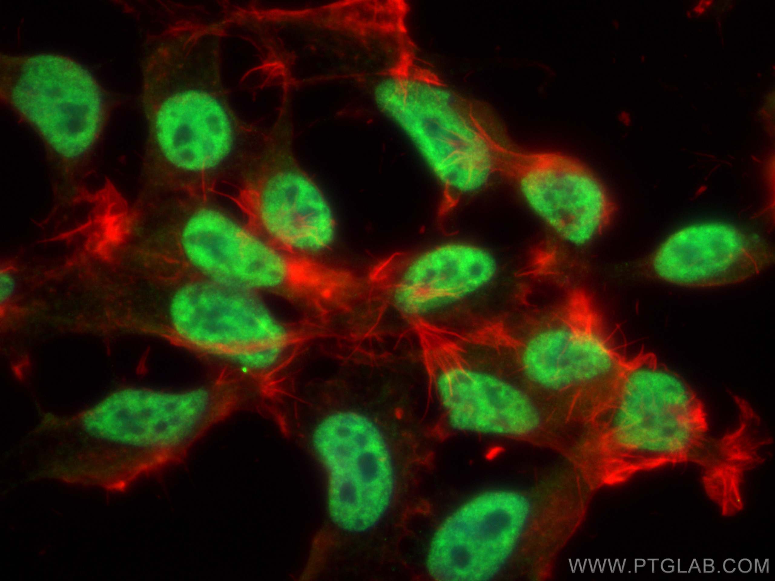 IF Staining of HEK-293 using 21399-1-AP