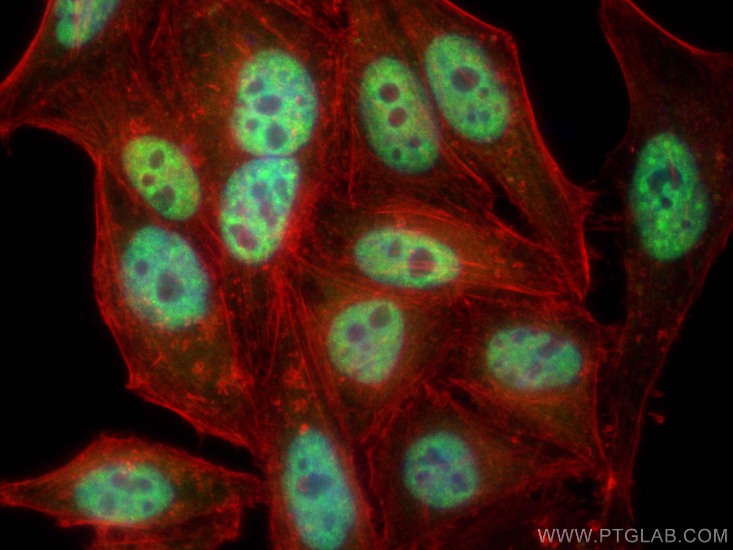 IF Staining of HepG2 using 21399-1-AP