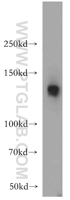 WB analysis of mouse heart using 21399-1-AP