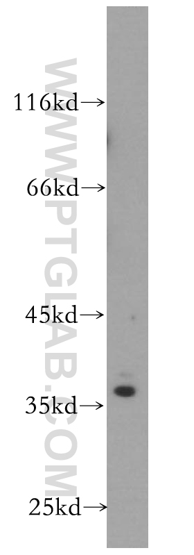 WB analysis of A431 using 18699-1-AP