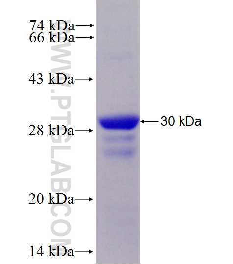 SRA1 fusion protein Ag28150 SDS-PAGE SRA1 fusion protein Ag28150 SDS-PAGE