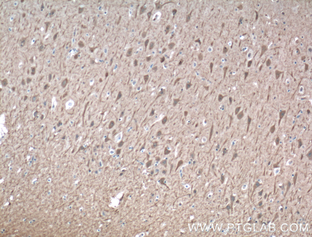 IHC staining of human brain using 24931-1-AP