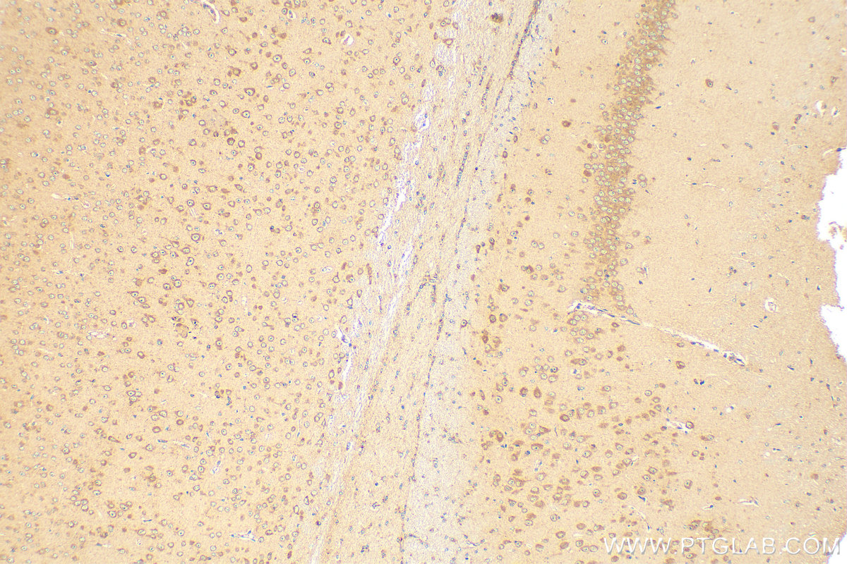 IHC staining of mouse brain using 24931-1-AP IHC staining of mouse brain using 24931-1-AP
