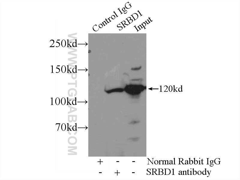 IP experiment of mouse brain using 24931-1-AP